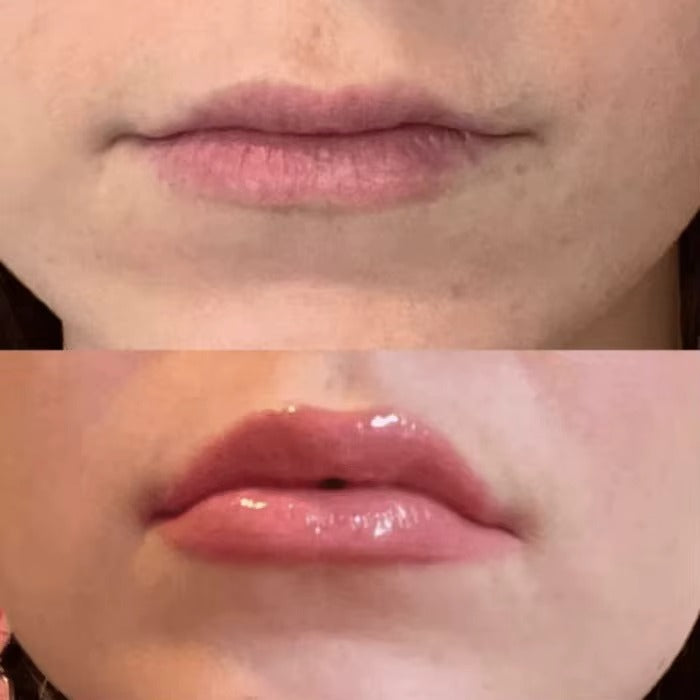 Lip Plumper ZENORIA